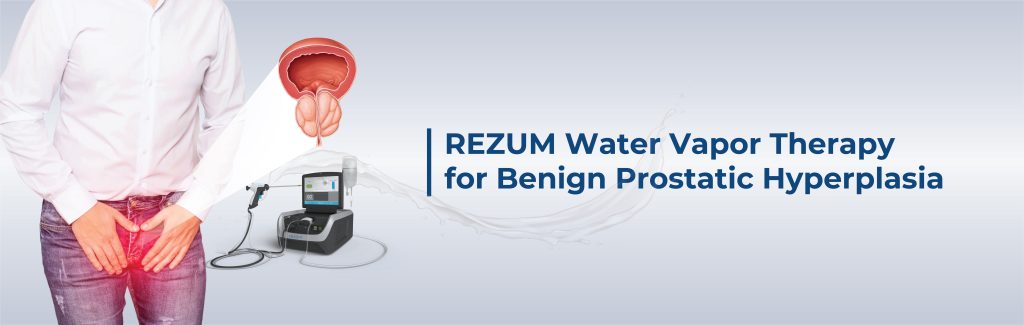 Introducing Rezum Water Vapor Therapy - REZUM FOR BPH 01 1024x325 